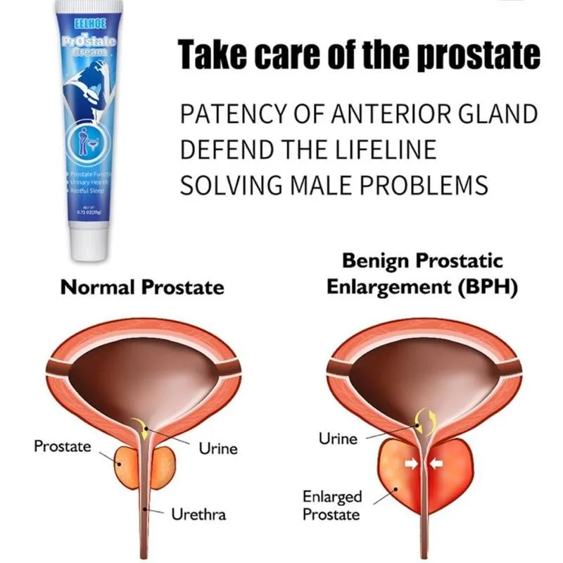 unguent pentru prostatită tratament real pentru prostatita